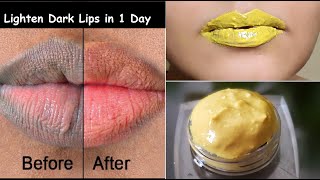 Lighten Dark Lips in 1 Day & Get Baby Soft Lips & Pink Lips - Lip mask for Dry Lips & Chapped Lips