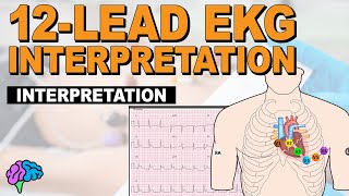 The SIMPLE Steps of 12Lead EKG Interpretation  EXPLAINED CLEARLY!