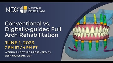 Conventional vs. Digitally-guided Full Arch Rehabilitation