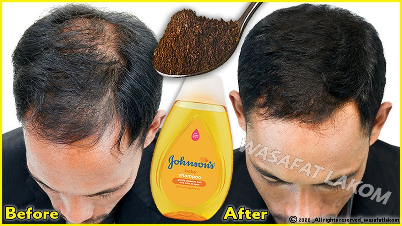 Put these ingredients in your shampoo, 🌱 it accelerates hair growth and