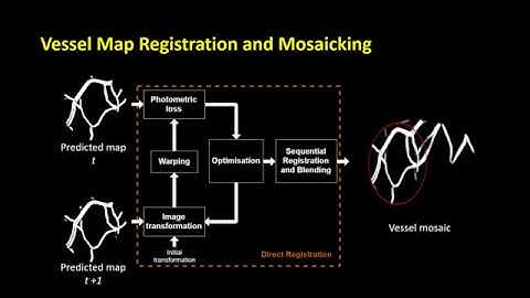 [MICCAI 2020] Deep Placental Vessel Segmentation for Fetoscopic Mosaicking