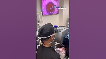 Monovision explanation