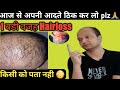 Hairfall &amp; Hairloss main reason and its Solution  For Neo Hair Lotion Users 🤔