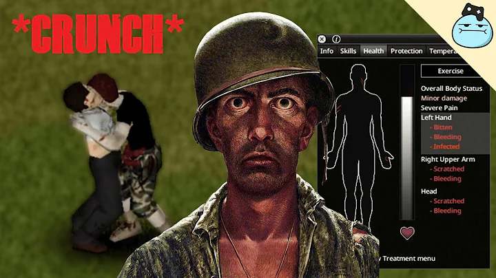 Types Of Players When They Get Bitten - Project Zomboid