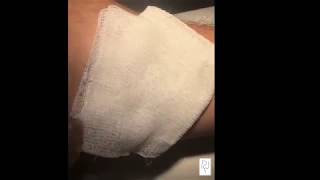 Ameliyatlardan Sonra Kesi Hatlarının Pansumanı- Doç. Dr. Nebil Yeşi̇loğlu