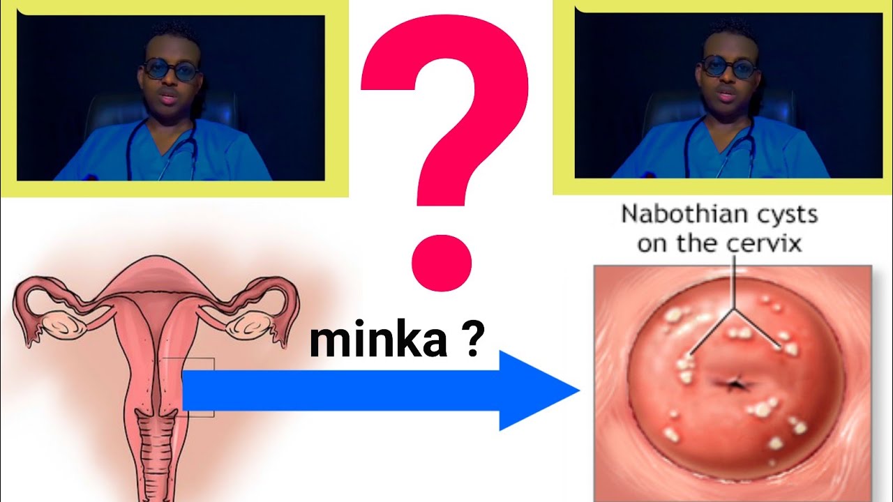 Naxodkada fohishaga qanday buyurtma berish mumkin Naxodkada fohishaga qanday buyurtma berish mumkin