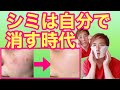 【シミが消える 】シミを自分でとる方法