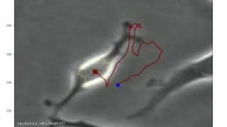phase contrast cell tracking