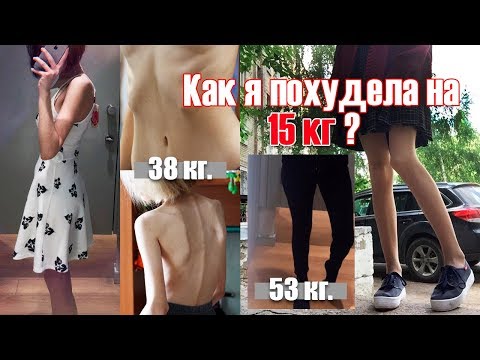 КАК Я ПОХУДЕЛА НА 15 КГ | Анорексия и булимия | Фото ДО и ПОСЛЕ