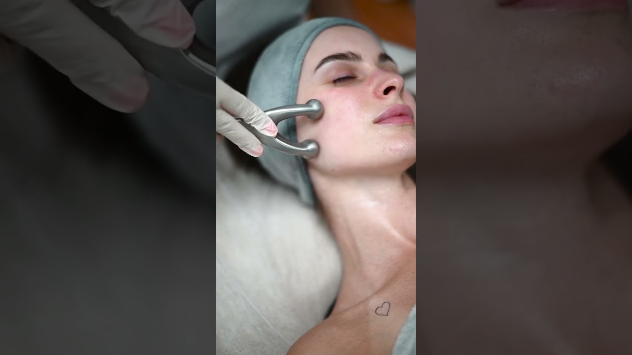 Indiba revolutionary RF technology for cosmetic procedures  