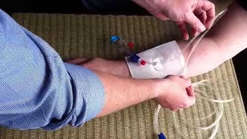 TIVA MULTIPLE INFUSION SETS/GLOBAL MEDICAL ADVANCED SAFETY