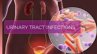 3D Animation of Urinary Tract Infections ( Signs,Symptoms \& Treatment )