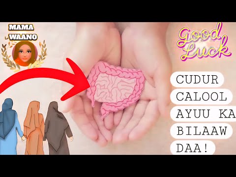 LAMA HURAAN WAA COOWS KA JIILAAL WALIGAA U ISTICMAAL DABIIBKAADA DABIICI