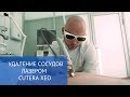 Удаление сосудов лазером Cutera XEO