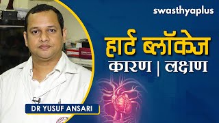 हार्ट में ब्लॉकेज - कारण, लक्षण Yusuf Ansari On Heart Blockage In Hindi Causes, Symptoms
