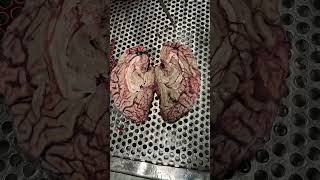 Doctor vlogs #forensics #vlogs #education #chemistry #exam #internship #doctor