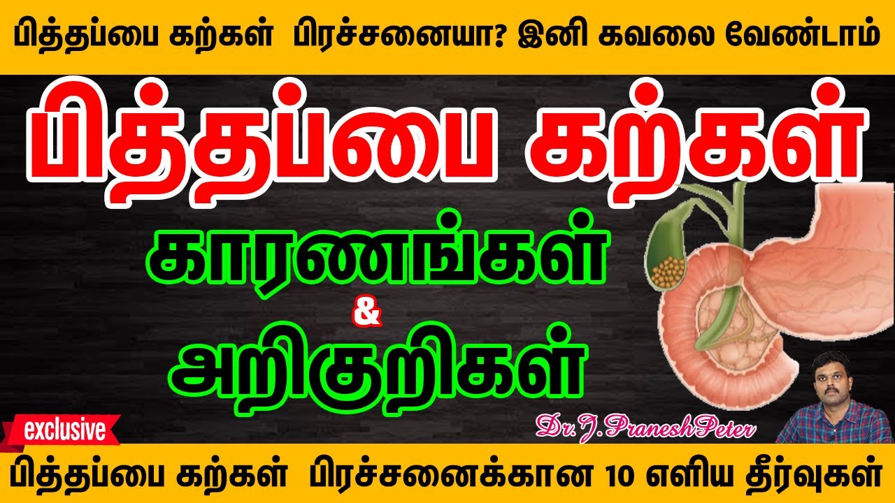 GALLSTONES | பித்தப்பை கற்கள் வர காரணங்கள்&அறிகுறிகள்|TOP10 TIPS & HOME REMEDIES OF GALLSTONES|TAMIL