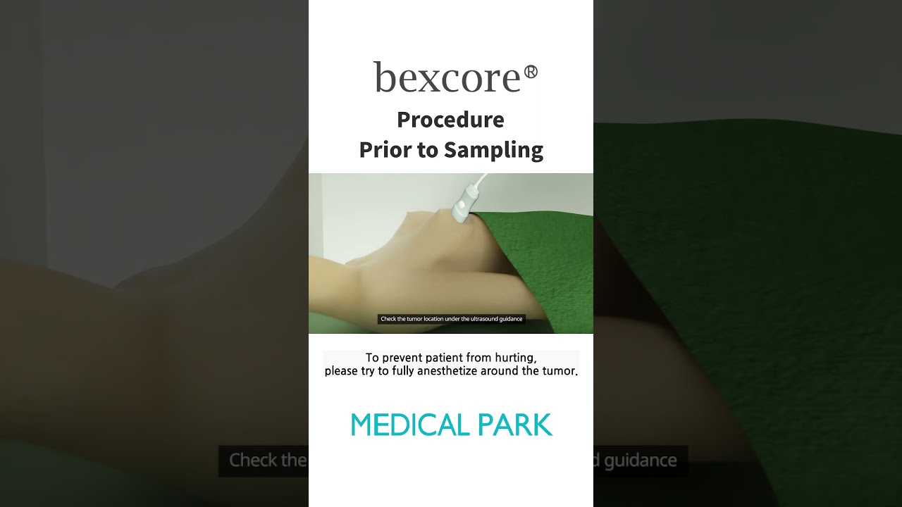 [Bexcore] Vacuum Assisted Breast Biopsy System - Procedure Prior to Sampling