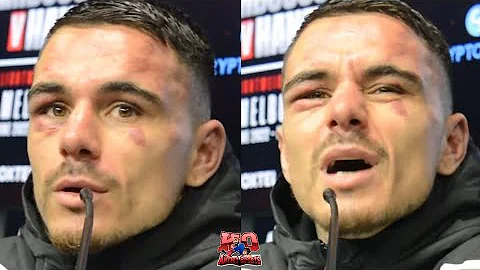 WOW! "Your face looks like it!" Aussie reporter go...