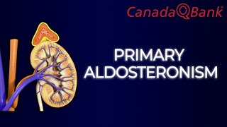 Primary Aldosteronism