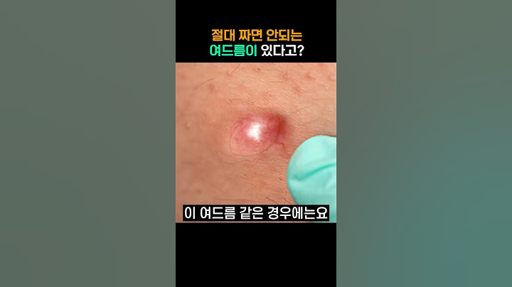 혹시 이런 여드름 생기셨나요? 절대 짜면 안돼요!😱 #여드름 #피지낭종