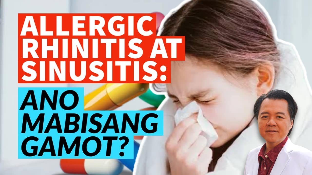 Allergic Rhinitis at Sinusitis. Ano Mabisang Gamot?
