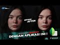 Mudahkah Menghilangkan Bekas Jerawat di Foto Online dengan Cepat?