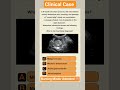 Radiology Quizzes #medical #radiology #medicine #medicalstudent #medicaleducation #nursingstudent
