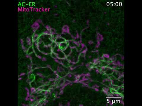 underjordisk lammelse udtale Schiavon et al., bioRxiv/Nature Methods 2020 - YouTube