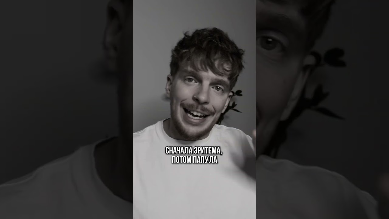 Подробно про синдром Лайелла или рассказал в последнем посте в нельзяграме @evgenynikitin