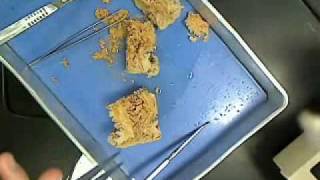 Dissecting Sea Anemone Part 3.wmv
