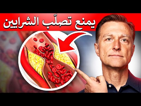 بدونه تتصلب الشرايين أين يوجد فيتامين ك2 الذي يمنع تراكم الكلس في القلب والشرا يين