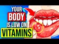 8 Warning Signs That Your Body Is Low On Essential Vitamins