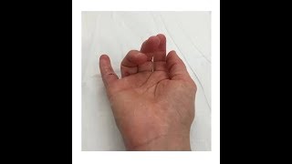ON Series: Hand injuries for small businesses