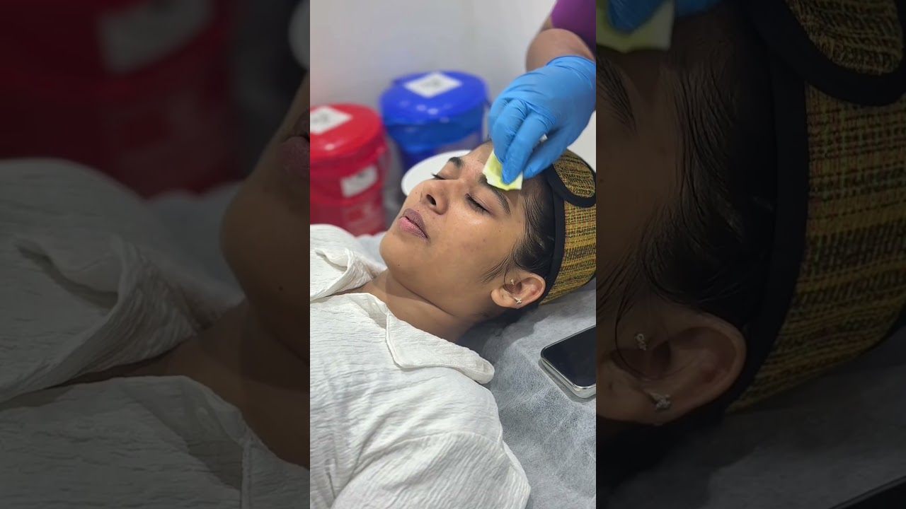 Black Peel treatment at Maynee Clinic Chennai — click to play