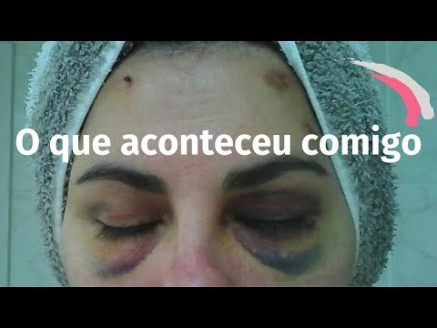 Vídeo: Explicações Farmacológicas, Fisiológicas E Neurológicas Para A Experiência De Morte - Visão Alternativa