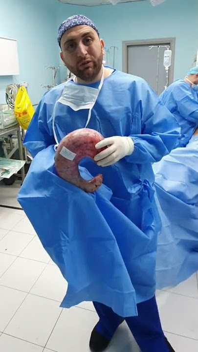 شاهد شكل المعدة بعد العملية