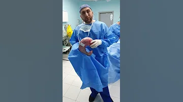 شاهد شكل المعدة بعد العملية 