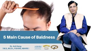 गंजापन कैसे रोके | 5 Main Cause of Baldness in Men | Stop Going Bald | Dr. Anil Garg