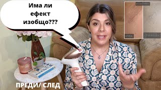 :     Philips Lumea-     4 !?