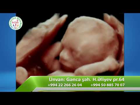 Video: Doğuş zamanı fetal monitorinq nədir?