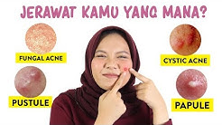 Jenis Jerawat dan Cara Mengatasinya | Skincare101 - Durasi: 4.45. 