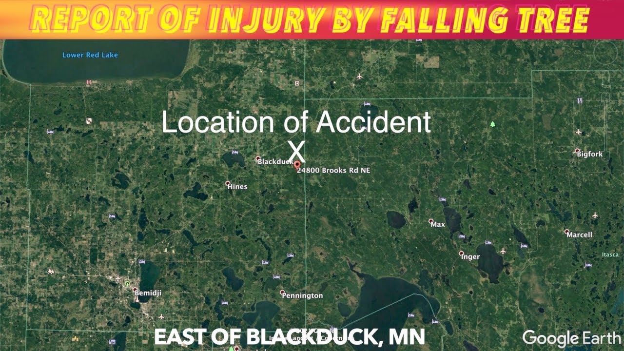 Report Of Injury By Falling Tree Near Blackduck, MN YouTube
