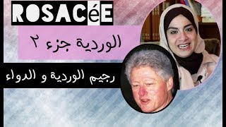 الجزء 2من روتين الوردية/ الريجيم والعلاج  rosacée/ كريمات لاحمرار البشرة