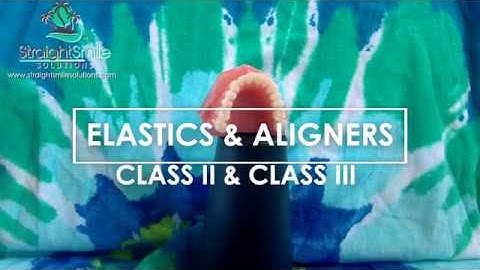 Precision Cuts, Elastics and Rubberbands for Aligners: Slots and Buttons