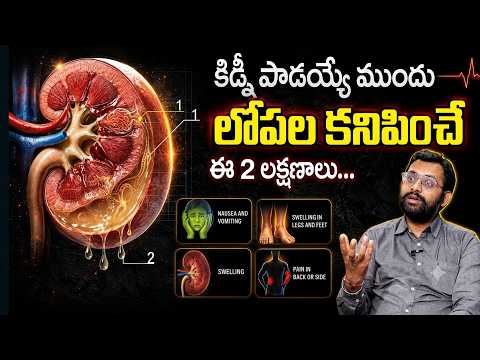 కిడ్నీ పాడయ్యే ముందు కనిపించే లక్షణాలు...|| Dr .Chetan Raj about Kidney Damage and its Home Remedies