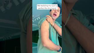 My scar is perfect for this trend #trend #shorts #explore #fyp #relatable #funny #pov #viral #yt