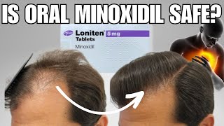 Celebrity How Safe is Oral Minoxidil? Dr. Sergio Vaño Answers Net Worth