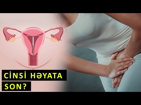 Video: Niyə məmə halosu artdı?