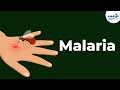 Malaria and Life Cycle of Plasmodium | Diseases | Don't Memorise